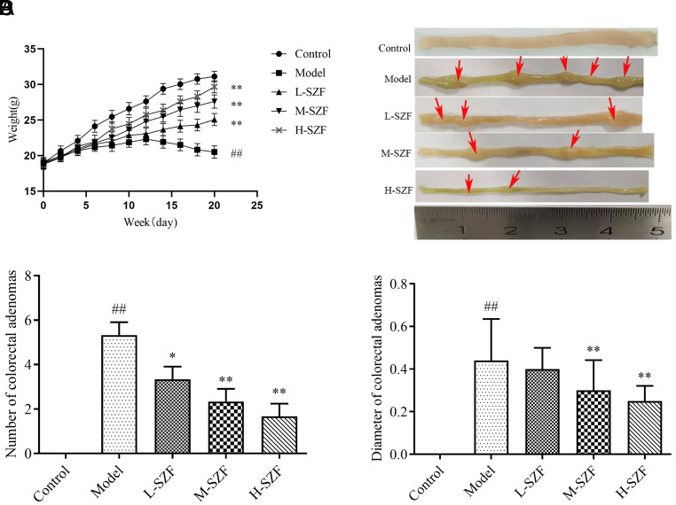 Modulation of Intestinal Barrier Function and Wnt/β- Catenin Pathway by Sanzi Formula in Colorectal Adenoma Development.