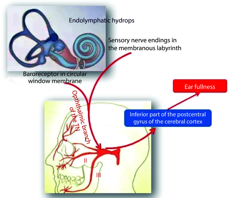 The advancements in understanding the pathogenesis of ear fullness.