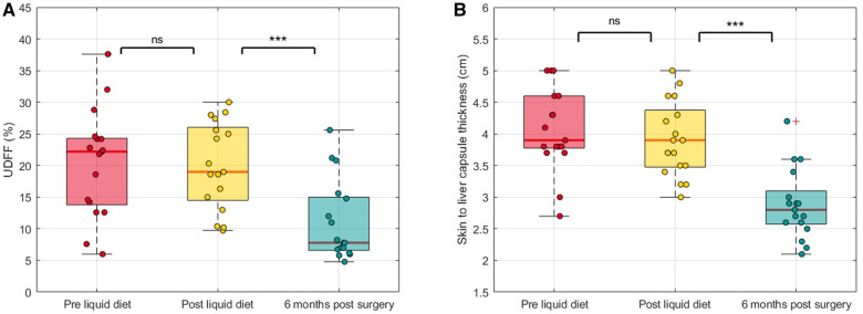 Quantifying changes in steatotic liver disease after bariatric surgery using ultrasound-derived fat fraction.