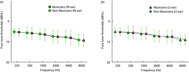 Non-Musicians Experience Early Aging in Speech Perception in Noise Abilities Compared to Musicians.