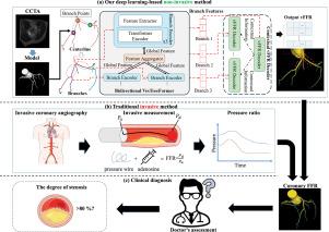 Bi-VesTreeFormer: A bidirectional topology-aware transformer framework for coronary vFFR estimation