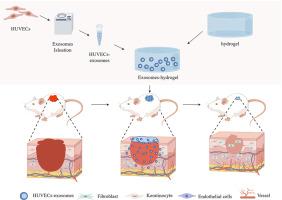 A temperature-sensitive chitosan hydrogels loaded with nano-zinc oxide and exosomes from human umbilical vein endothelial cells accelerates wound healing