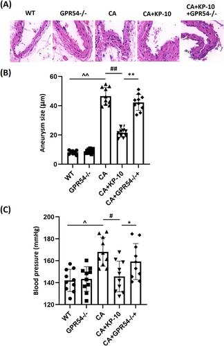 Kisspeptin-10 Prevents the Development of Cerebral Aneurysms by Reducing the Expression of Egr-1