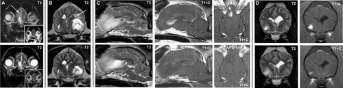 Acute Evolution of Neurological Signs and Magnetic Resonance Imaging Features in Dogs With Brain Tumors Receiving Treatment With Corticosteroids and Anticonvulsants
