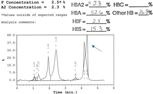 Impact of Voxelotor on Red Blood Cell Exchange Therapeutic Procedures: Evaluation of Multi-Institutional Procedure Data