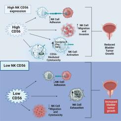 CD56 on intratumoral NK cells: orchestrating NK cell-mediated anti-tumor effects in bladder cancer