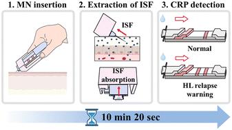 Development of a high-performance sliding microneedle-lateral flow immunoassay strip device for ultra-rapid point-of-care diagnosis†