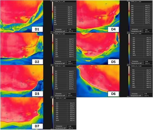Skin Protection With Hydrofibre Foam and Silicone-Based Dressing Can Help Prevent Pressure Injuries: A Preliminary Evaluation in Brazil