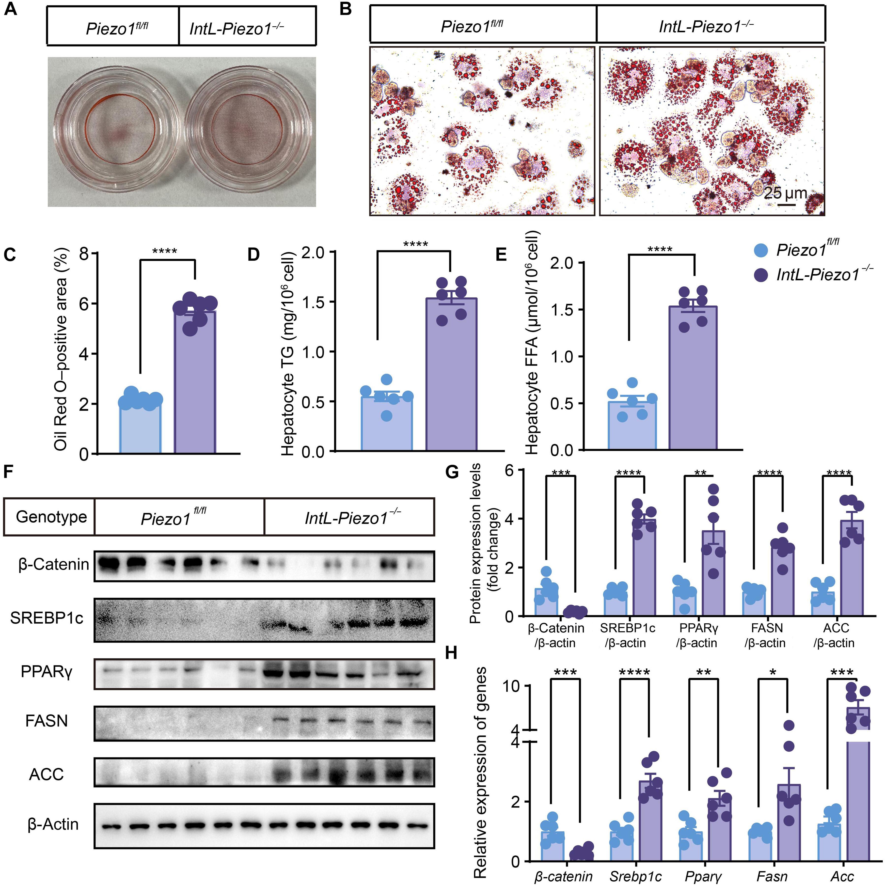 Intestinal L-cell mechanoreception regulates hepatic lipid metabolism through GLP-1