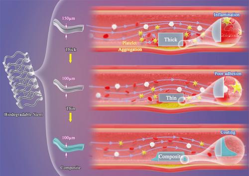 Bioresorbable Composite Polymeric Stents: Alleviating Deployment Damage and Maintaining Significant Mechanical Properties