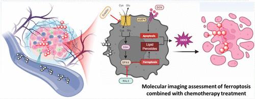 Near-Infrared Fluorescence Reporter Offering Real-Time Tracking and Differential Assessment of Ferroptosis Progressions In Vivo