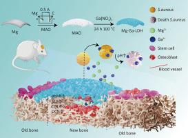 MgGa layered double hydroxides coating endow magnesium with antibacterial and osteogenic properties for guided-bone regeneration application