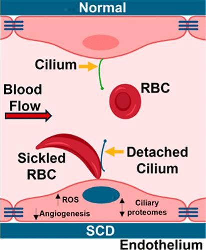 Comparative Proteomic Analysis Reveals Altered Ciliary Proteins in Sickle Cell Disease