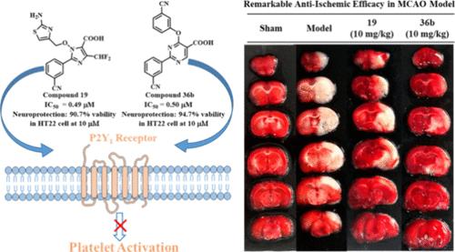 Design, Synthesis, and Biological Evaluation of 4-(Difluoromethyl)-1H-imidazole-5-carboxylic Acids/4-(3-Cyanophenoxy)pyrimidine-5-carboxylic Acids as P2Y1 Receptor Antagonists for Ischemic Stroke Treatment
