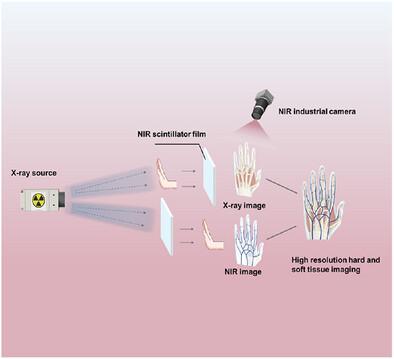 High-Resolution Imaging of Biological Soft and Hard Tissues Using NIR Scintillators