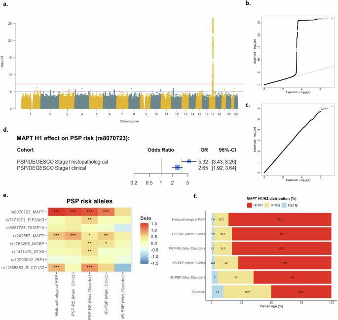 A Spanish-Portuguese GWAS of progressive supranuclear palsy reveals a novel risk locus in NFASC