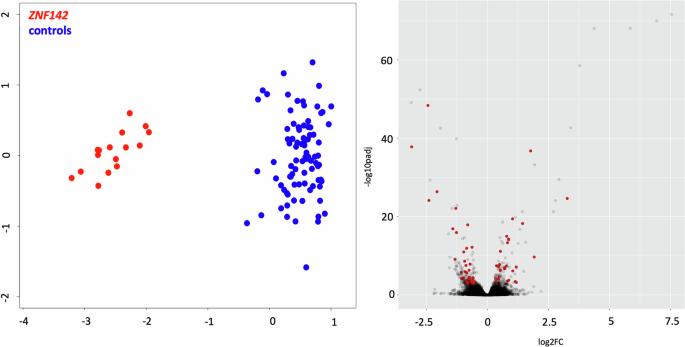 Biallelic loss-of-function variants in ZNF142 are associated with a robust DNA methylation signature affecting a limited number of genomic loci