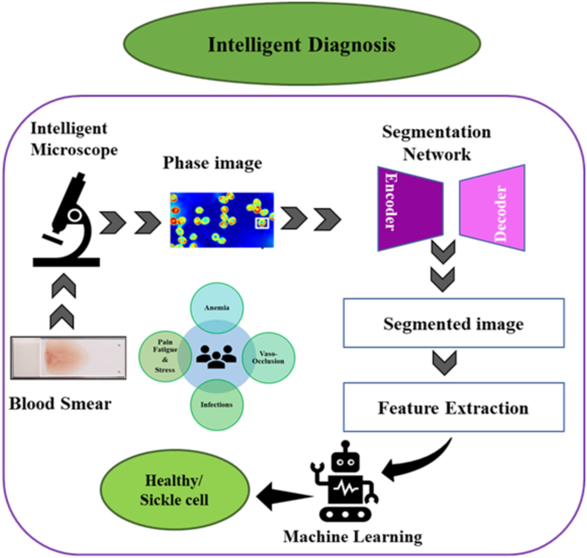 Development of 3D Intelligent Quantitative Phase Microscope for Sickle Cells Screening