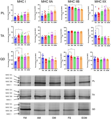 The impact of frailty syndrome on skeletal muscle histology: preventive effects of exercise
