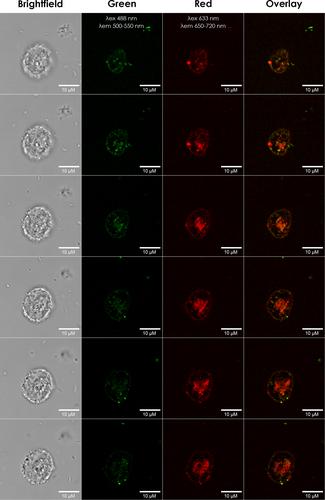 Acanthamoeba castellanii Can Facilitate Plasmid Transfer Between Environmental Pseudomonas spp