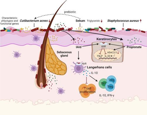 Pathogenesis and Treatment of Atopic Dermatitis: Lessons From China