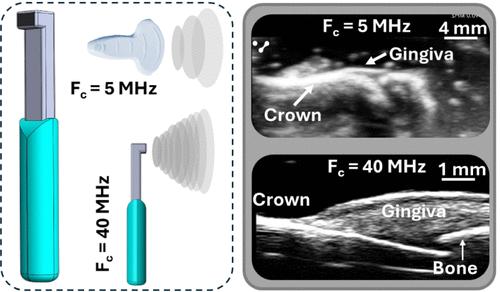 Performance Evaluation of a Miniaturized, Toothbrush-Shaped Ultrasound Transducer for Periodontal Imaging