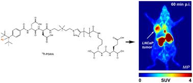 Development and clinical potential of 18F-PSiMA for prostate cancer PET imaging†