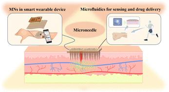 Toward next-generation smart medical care wearables: where microfluidics meet microneedles
