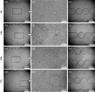 Design and Characterization of Bionic Lymphatic Valve Based on Thin Film Shell Theory