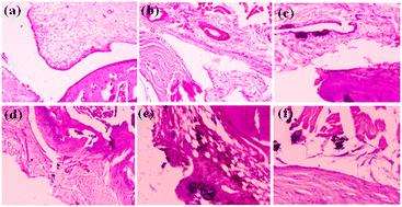 Interfacial response of Mg–Ca–Si–Zr nanoparticles for transformative orthopedic therapeutics