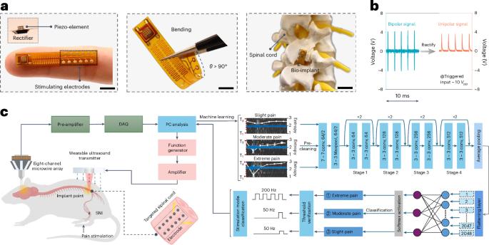 Ultrasound-induced wireless implantable stimulator for adaptive pain management