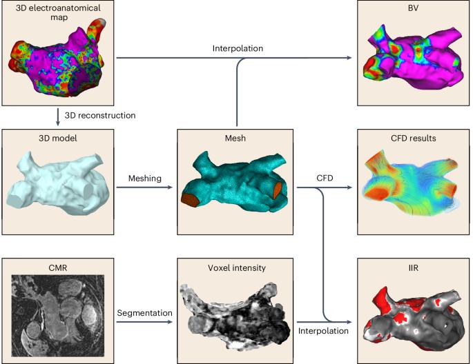 Left atrial wall shear stress correlates with fibrosis in patients with atrial fibrillation