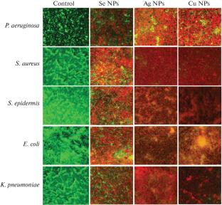 Laser-Ablative Fabrication of Materials for Nanolubricants with Bactericidal Nanoparticles and Study of Their Antiseptic Effect