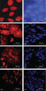 Rational Design of Heterometallic Water-Soluble Yttrium Complexes with Selective In Vitro and In Vivo Anticancer Activity