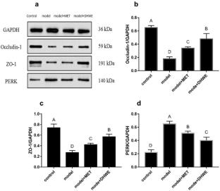 A plasma metabolomic analysis revealed the metabolic regulatory mechanism of the water extract of Dendrobium huoshanense in improving streptozotocin-induced type 1 diabetes model rats