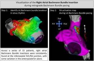 The Bachmann bundle pacing target: Retrograde mapping and microstructural correlation
