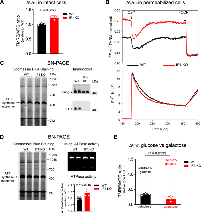 Mitochondrial membrane hyperpolarization modulates nuclear DNA methylation and gene expression through phospholipid remodeling