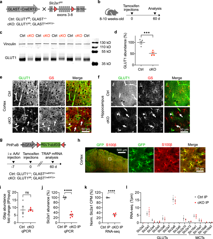 Astrocytic GLUT1 deletion in adult mice enhances glucose metabolism and resilience to stroke