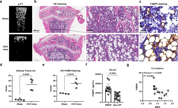 FABP4 inhibition suppresses bone resorption and protects against postmenopausal osteoporosis in ovariectomized mice