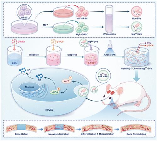 MiR-451a-Enriched Small Extracellular Vesicles Derived from Mg2+-Activated DPSCs Induce Vascularized Bone Regeneration through the AKT/eNOS/NO Axis