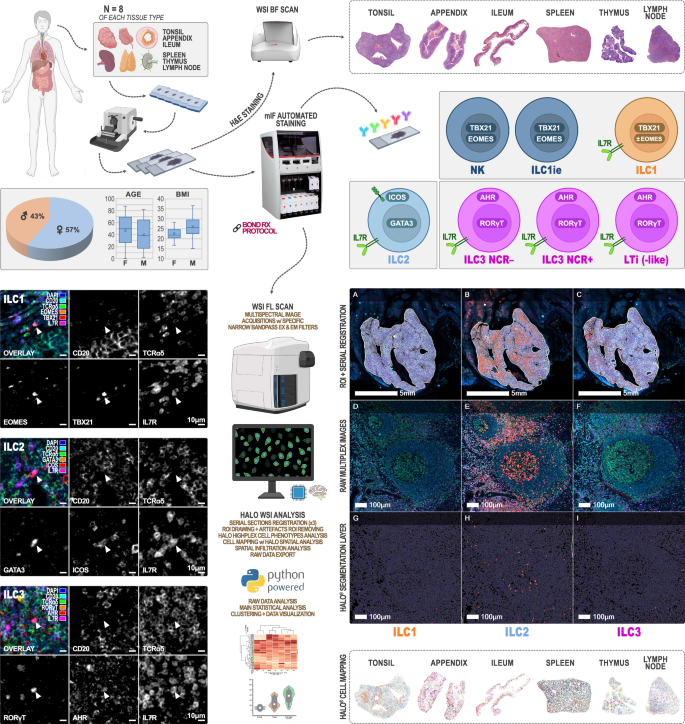 Spatial mapping of innate lymphoid cells in human lymphoid tissues and lymphoma at single-cell resolution