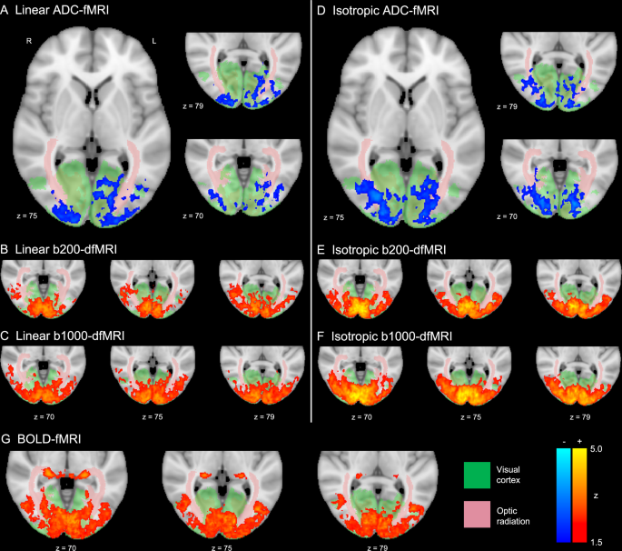 Mapping grey and white matter activity in the human brain with isotropic ADC-fMRI