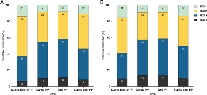 Association between ventilation-perfusion matching improvement during initial prone positioning and ICU mortality in patients with moderate to severe ARDS: a prospective two-center study.