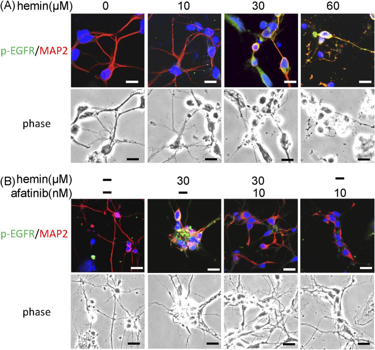 Involvement of EGFR-AKT signaling in hemin-induced neurotoxicity.