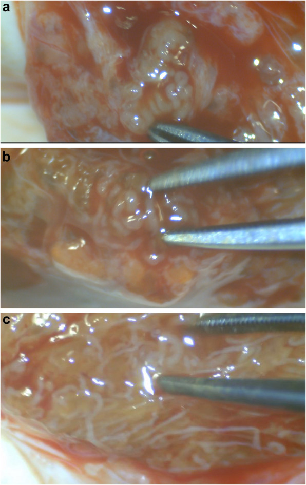 Evaluation of the predictors of successful sperm retrieval of micro-TESE in cases with mosaic Klinefelter versus cases with non-mosaic Klinefelter: a prospective case series study.