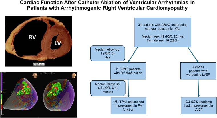 Cardiac function after catheter ablation of ventricular arrhythmias in patients with arrhythmogenic right ventricular cardiomyopathy.