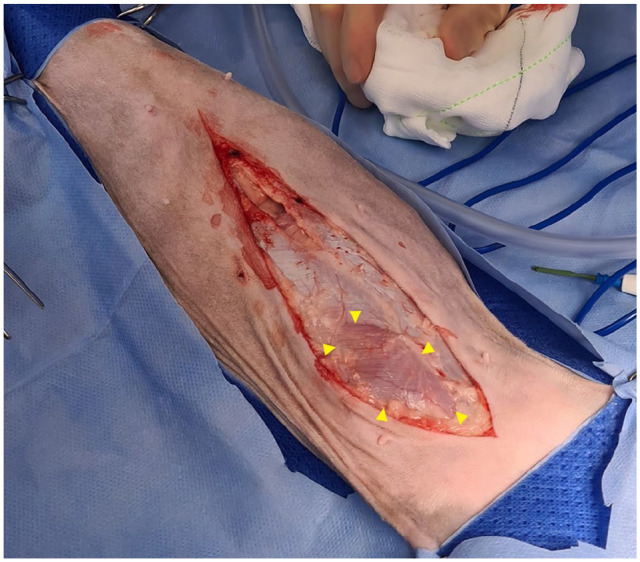 Acute non-traumatic abdominal pseudoherniation in a geriatric cat.