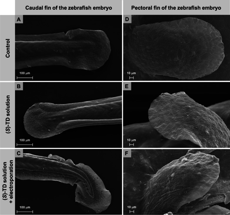 New insight into teratogenic effects of (S)-thalidomide in zebrafish embryos growing inside the chorion and subjected to electric pulses.