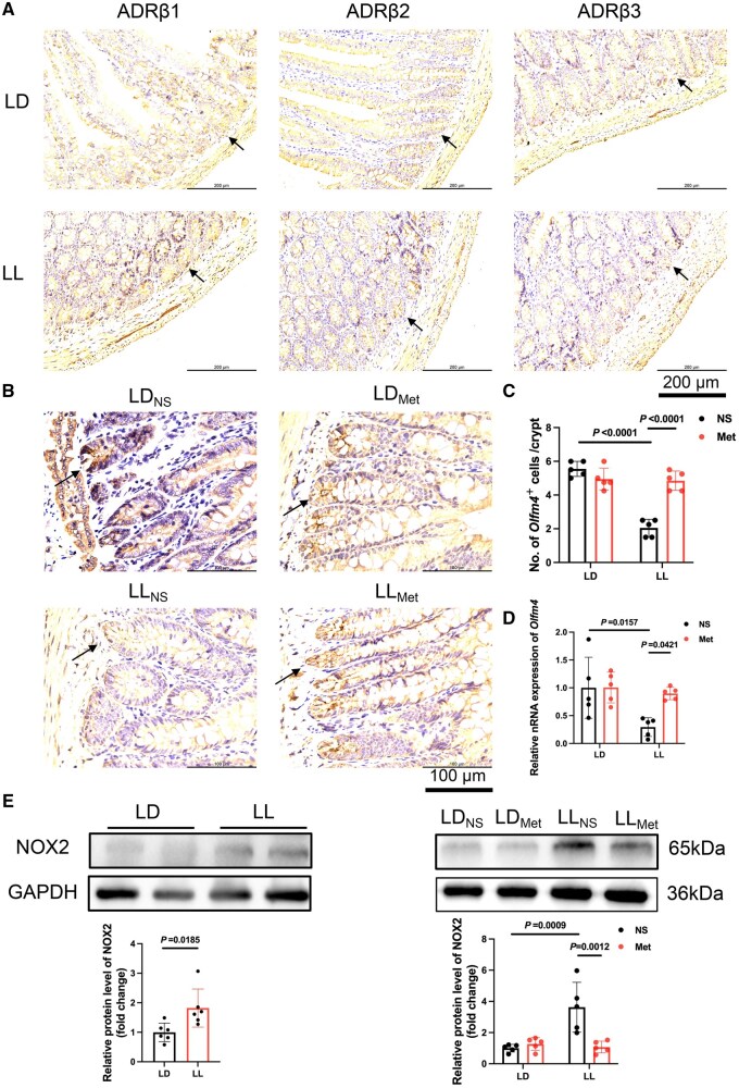 Long-term exposure to constant light disrupts intestinal stem cells through sympathoexcitation-induced Wnt5a signaling inhibition.