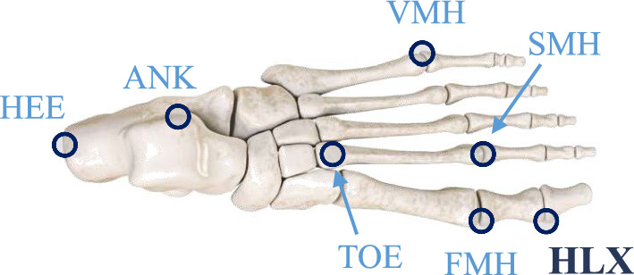 Automatic detection of human gait events: a simple but versatile 3D algorithm.